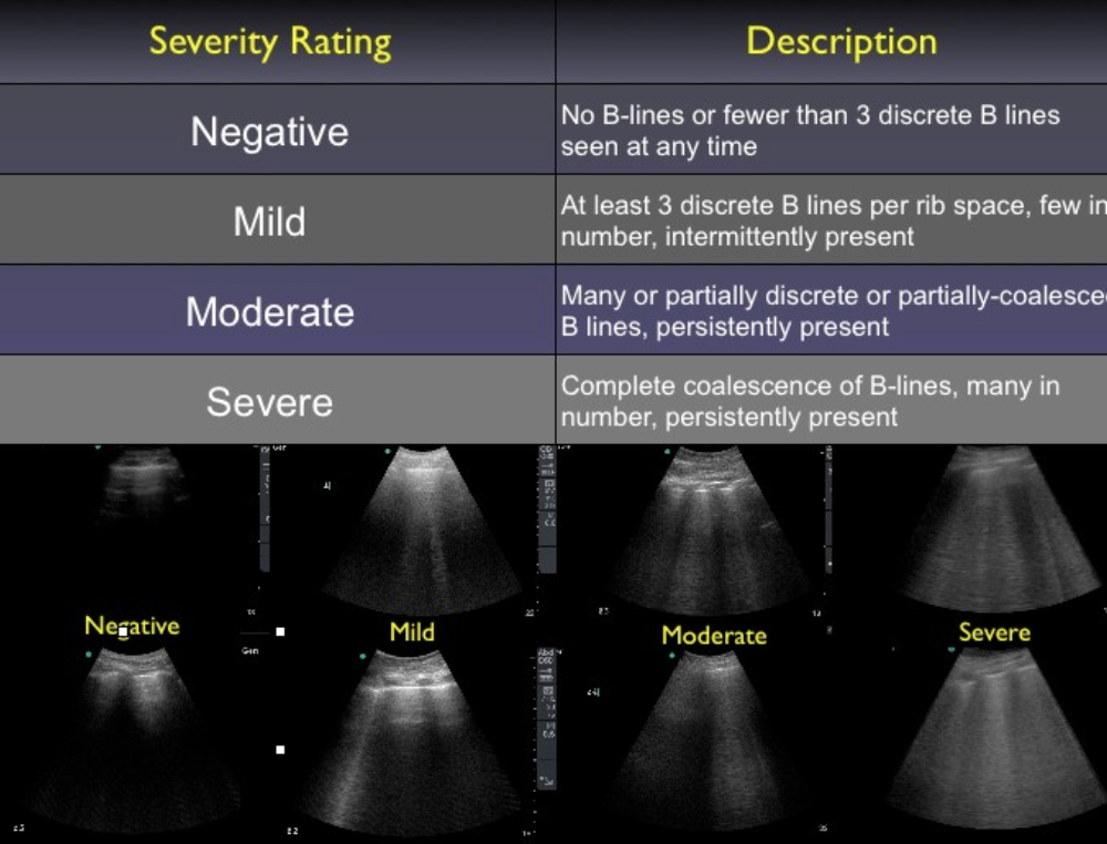 04_ChartB-LineSeverity.png