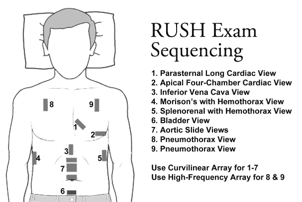 05_DiagramRUSHSequence.png